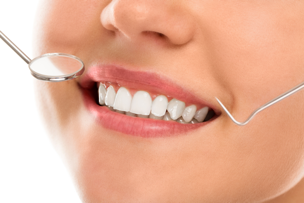 Tratamentos com Lentes de Contato Dental: A Importância da Naturalidade